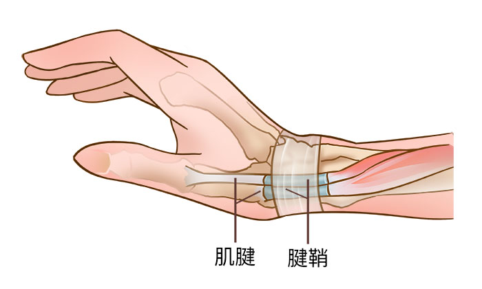 图片关键词